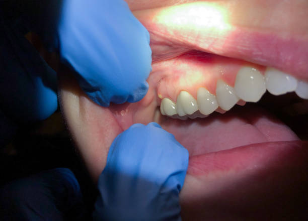 Best Emergency Treatment for Jaw Pain or Injury in Florence, MT